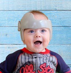happy baby wearing the cranial remodeling helmet