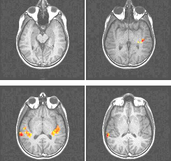 4 quadrants of brain scan