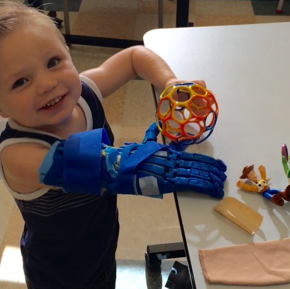 Hayden playing while using a 3D printed hand prostheses