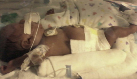 Leondre en el hospital con sonda de alimentación.