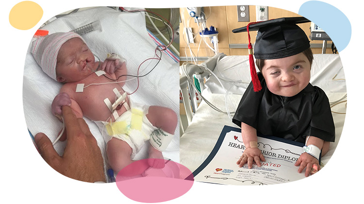 baby tad right after surgery and after graduating from intensive care